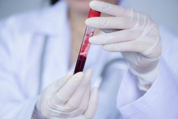 Jak przygotować się na badanie krwi?